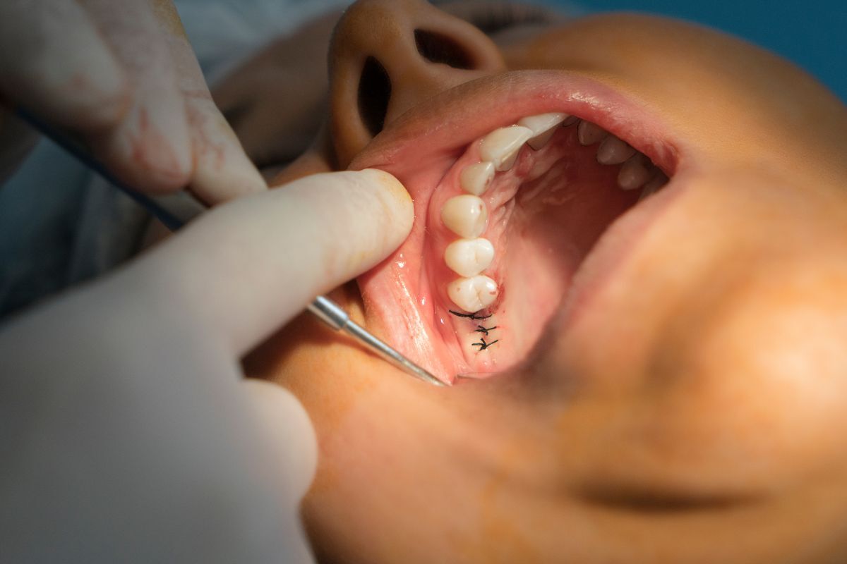 Dental Implant Safety Surgery